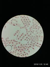 Check spelling or type a new query. Microscopic Image Of Cells In Onion Root Tip The Stages Of Mitosis Are Prophase Metaphase Anaphase And Telophase The Microscopic Images Mitosis Microscopic