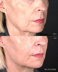 Dr Darren McKeown (@drdarrenmckeown) · Glasgow