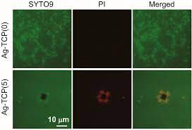 Ijms Free Full Text Bactericidal And Bioresorbable Calcium Phosphate Cements Fabricated By Silver Containing Tricalcium Phosphate Microspheres Html