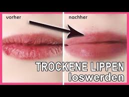 Ein lippenpeeling muss reinigend und gleichzeitig pflegend sein. Hausmittel Gegen Trockene Und Brennende Lippen Hausfrauentipps De