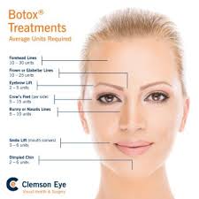 Botox Facial Diagram Wiring Diagrams