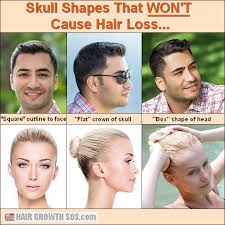 It's one of the other hair loss treatments approved by the fda to. Androgenetic Alopecia In Women And Male Pattern Baldness In Men The Cause Of This Type Of Hair Loss Is Not Wha What Causes Hair Loss Hair Loss Women Hair Loss