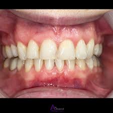 We did not find results for: Advanced Dental Care Blog Page 2 Of 14
