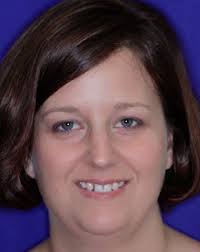 Dental Implant Services