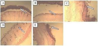 Image result for Psorospermum febrifugum