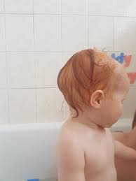 Maybe you would like to learn more about one of these? Large Lump On Back Of Dds Head Mumsnet