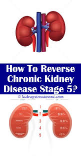 Can You Die From A Kidney Infection Polycystic Kidney Disease Kidney Disease Diet Kidney Disease
