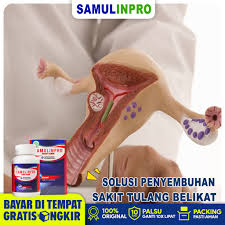 Sakit pada lutut dan siku bisa berupa rasa nyeri di satu titik atau di seluruh area lutut dan siku. Obat Nyeri Tulang Belikat Samulinpro Sehat Sendi Sehat Tulang Sendi Original 100 Bisa Cod Shopee Indonesia