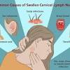 In most cases, throat cancer originates in the flat cells that line the inside of the throat, a muscular tube that extends from the nose to the bottom of the neck. 1