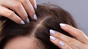 Loss of blood through heavy menstrual bleeding or wounds can cause anemia. Getting To The Root Of Hair Loss The New York Times