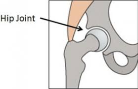 Consider ergonomic chair with lumbar support. Related Adult Hip Disorders International Hip Dysplasia Institute