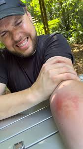 Stung by a flying bullet ant! #newvideo #letsgo
