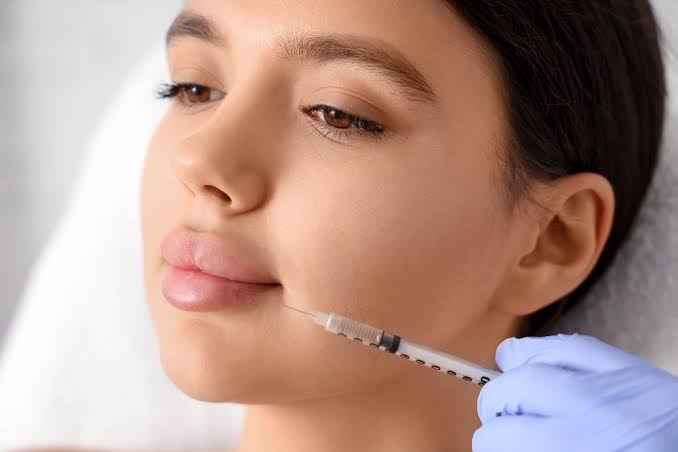 Before and after filler dissolving hyaluronidase treatment showing improved facial contour in Ponte Vedra Beach
