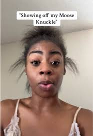 Fried Moose Knuckles