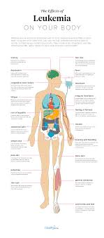 Anemia and related symptoms, such as fatigue, pallor, and a general. Weight Loss Hair Loss Fatigue Bruising Weightlosslook
