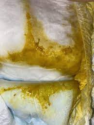 Caquita Con Mocos En Dieta Aplv Club De Bebes Septiembre 2020 Babycenter