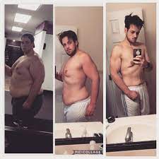 These are benign, meaning not cancerous. Managed To Lose 180 Lbs Over My First Two Years Of Law School Pics
