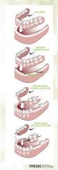 Image result for dentures