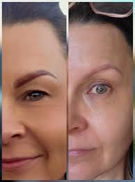 24 hour difference in skin and inflammation