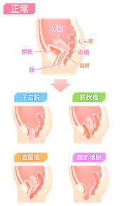ILACY（アイラシイ）