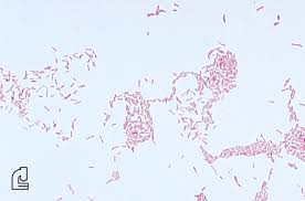 Gram Stain Lab Tests Online