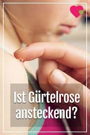 Ist Gurtelrose Ansteckend Gurtelrose Kinder Gesundheit Windpocken