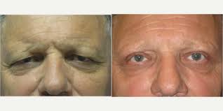 Prashant Soni, MD, Board Certified Plastic Surgeon