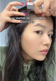 Micro Needling