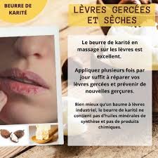 Levres Et Mains Gercees Mes Solutions Avec Les Huiles Essentielles Huiles Essentielles Aromatherapie En 2020 Baume A Levres Maison Levres Gercees Baume A Levres