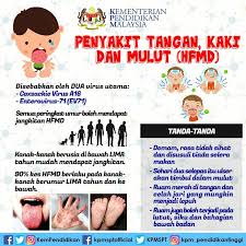 Gejala penyakit ini adalah demam, ruam pada tangan dan kaki, sakit tenggorokan, dan nafsu makan menurun. Infografik Kesedaran Penyakit Tangan Kaki Dan Mulut Hfmd