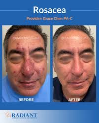 Radiant Dermatology & Aesthetics (@Radiantdermtx)