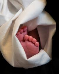 Image result for Neonatal Circumcision