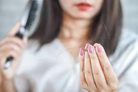 Last accessed may 23, 2019. 5 Ways To Fight Hair Loss Times Of India