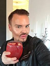 Svenske Robin är beroende av skönhetsingrepp: "Vill se ut som en  porslinsdocka"