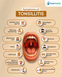 Image result for Tonsillitis