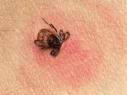 Lyme Disease Is Hard To Identify Increasing Rapidly Afmc