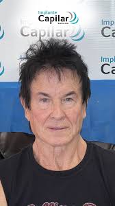 Sentite bien! 👨🏻‍🦲➡👨🏻 Utilizamos la técnica FUE, una técnica de  avanzada a nivel mundial, sin dolor ni cicatrices visibles. No dudes en  consultarnos, estamos realizando diagnósticos. Animate al cambio. #implante  #buenosaires #sincicatriz #