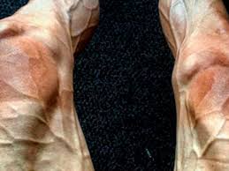 This content is imported from {embed. Must See Tour De France Cyclist Shares Shocking Photo Of The Effect The Race Has On His Legs You