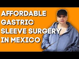 Gastric Sleeve Mexico Review