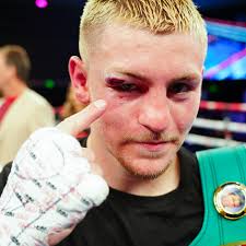 King Callum stays undefeated via technical decision after an accidental  headbutt stopped the fight 🤴🥊 [ #HFNBoxing