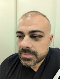 Hey @everyone! 🤗 I just wanted to extend the warmest thank you from the  bottom of my heart for all the concerning messages about our Ronnie Rachid  🥰🥰🙏 Im sorry I haven't