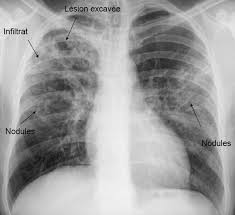 Smartfiches Medecine Smartfiches Radiology Radiography Medical