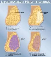Pin By Mi Skin Dermatology Center On Health And Beauty Plastic Surgery Liposuction Best Natural Skin Care