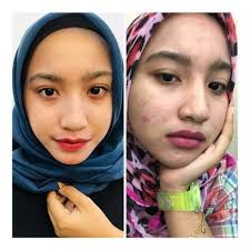 Setiap kepedihan pasti ada kemanisan akhirnya ����. Vsl Beauty Care Mia Posts Facebook