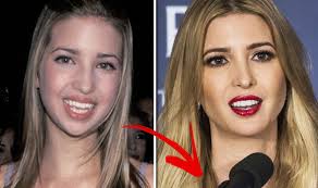 Tweet on twitter share on facebook pinterest. Ivanka Trump Plastic Surgery Doctor Speculates About Changing Face Express Co Uk