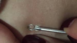 Emuaid.com has been visited by 100k+ users in the past month Black Head Removal Under Breast Hd Youtube