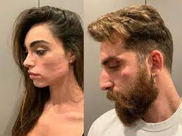Analisi completa dei dati instagram di lorella boccia. Lorella Boccia E Niccolo Presta Aggresiisione E Rapina A Roma