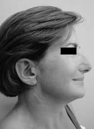 Cirugía Oral y Maxilofacial