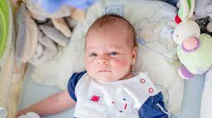 Kids with roseola may be irritable and tired and have mild diarrhea, a poor appetite, red eyes, swollen eyelids, a runny nose, or a sore throat. Viral Rashes In Babies Types Pictures Diagnosis Treatment