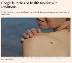 Most are harmless and disappear without treatment, but some may need to be treated. Nataly H Aranzamendi Phd Aranznataly Twitter